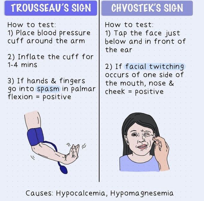 Trousseau's Sign Vs Chvostek's Sign