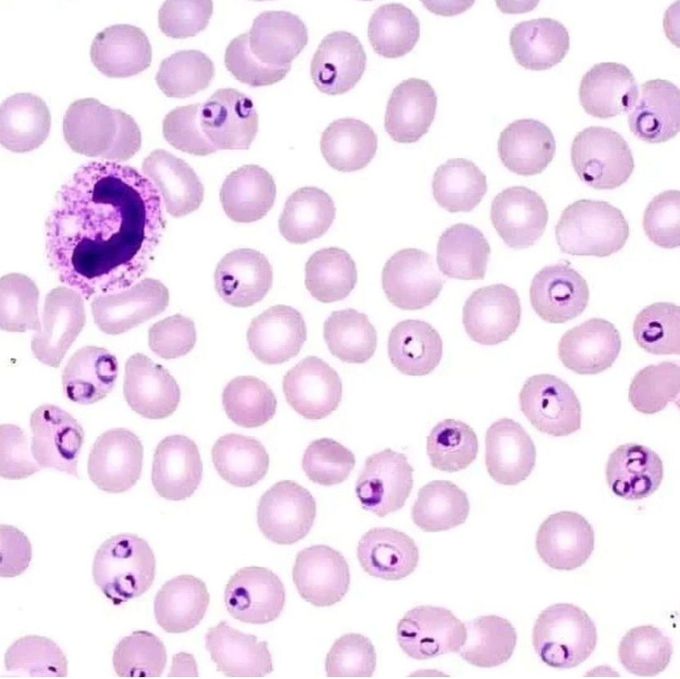 Plasmodium