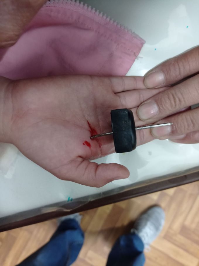 awl injury