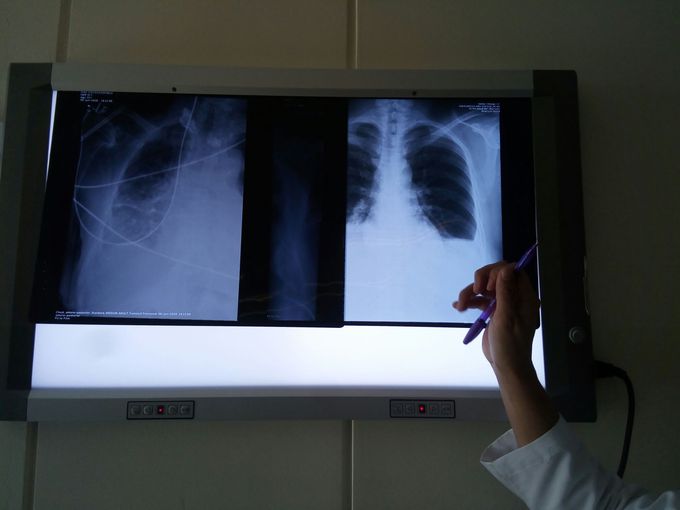 Peneetration of X Rays