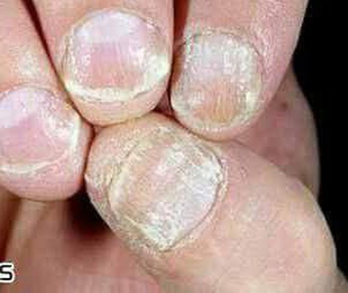 What is diagnosis this condition?