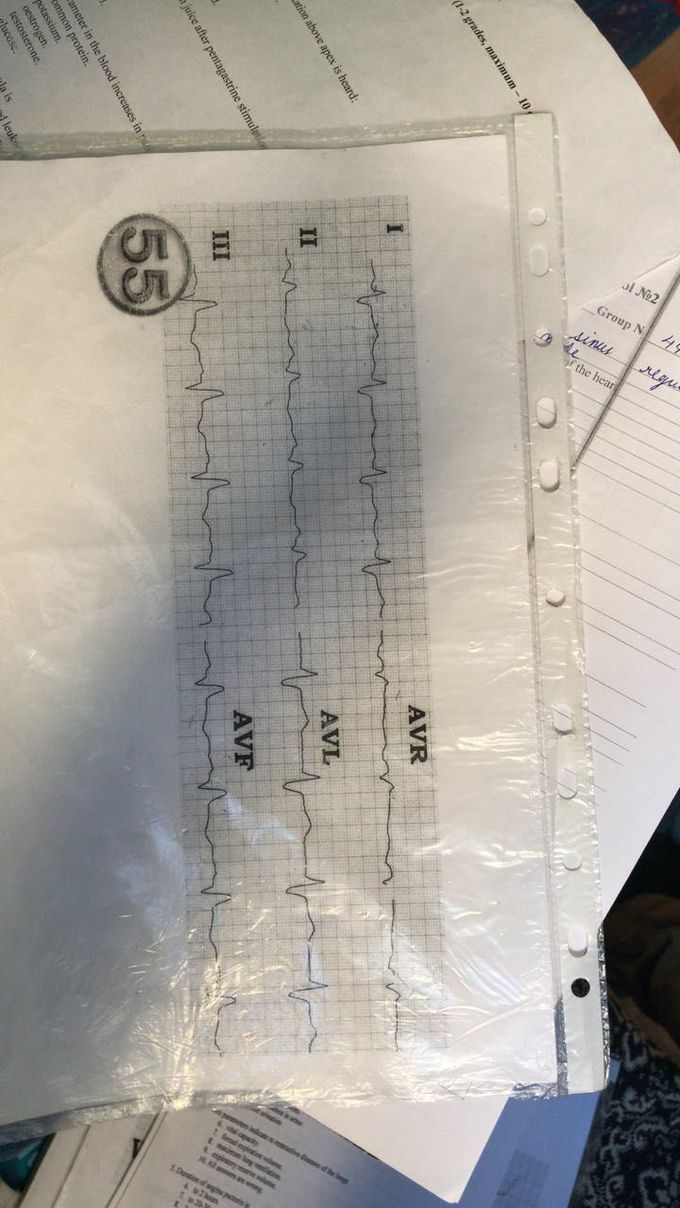 Diagnosis