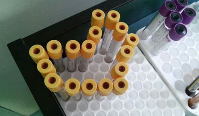 Blood test tubes