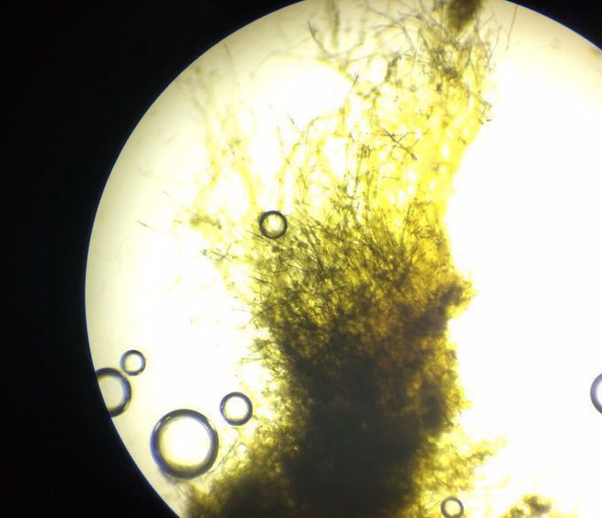 Characteristics of fungi under a microscope