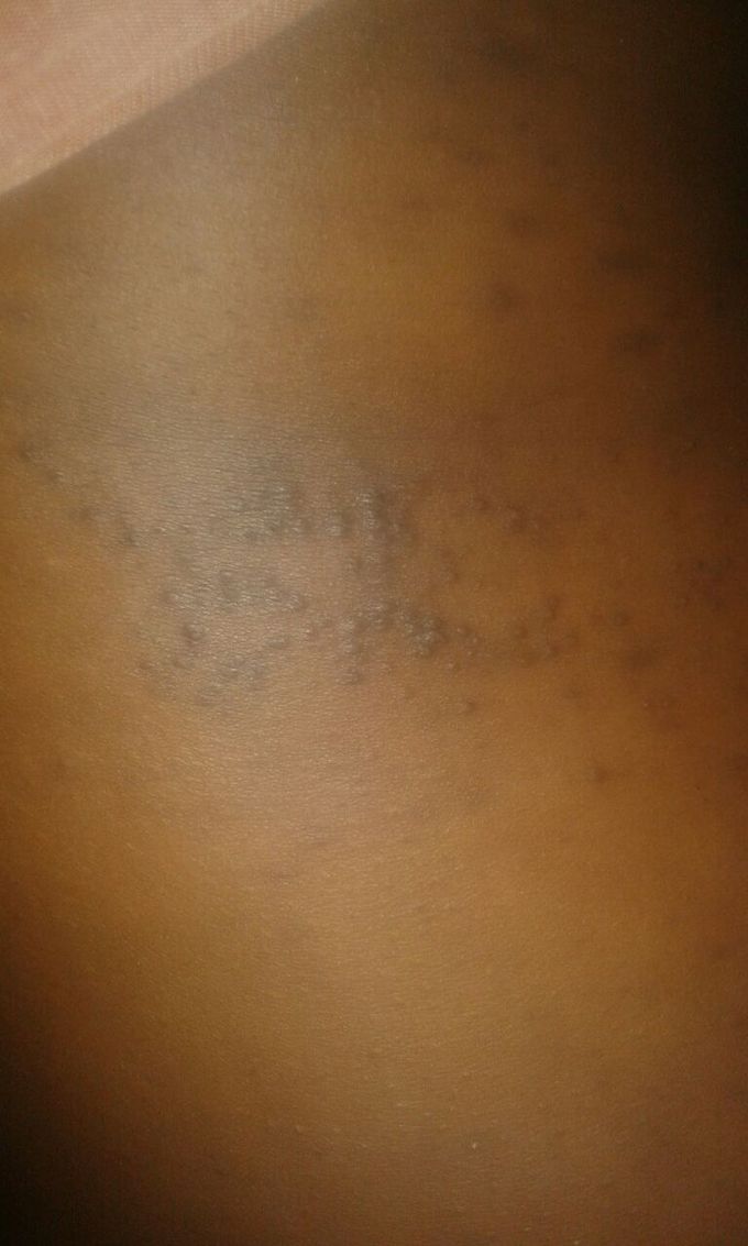 Diagnosis ?
