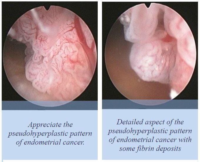 http://m.hysteroscopy.info/4/home_724574.html