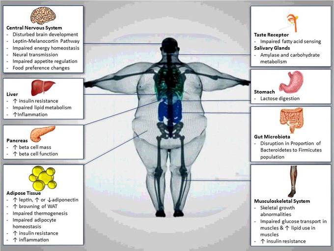 # Pathophysiology Obesity