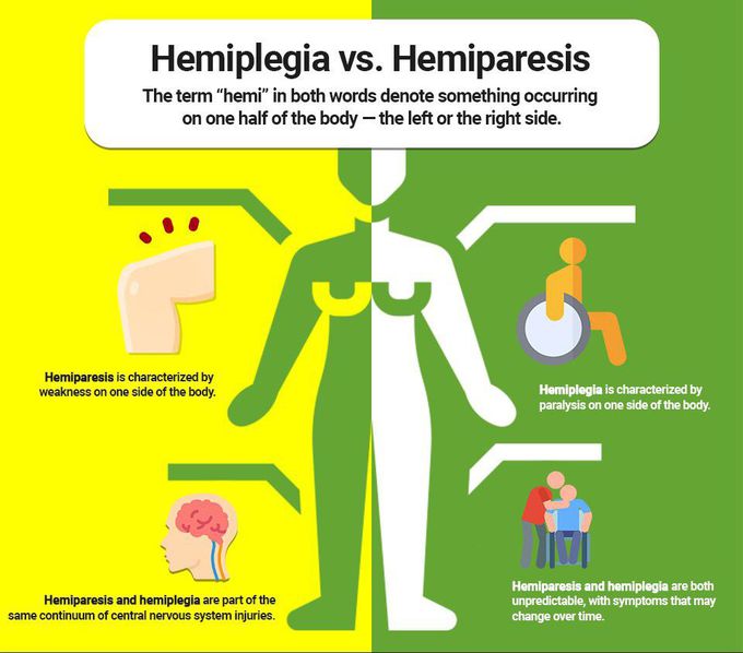 Difference between hemiplegia and hemiparesis