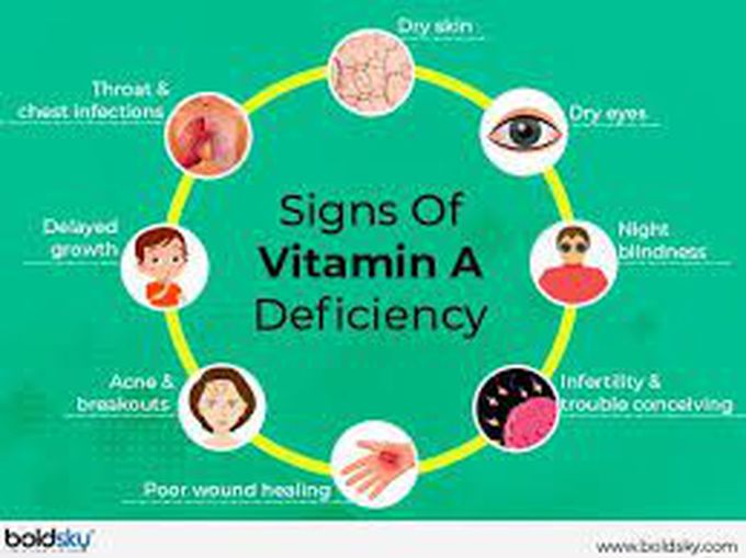 vitamin-a-deficiency-medizzy