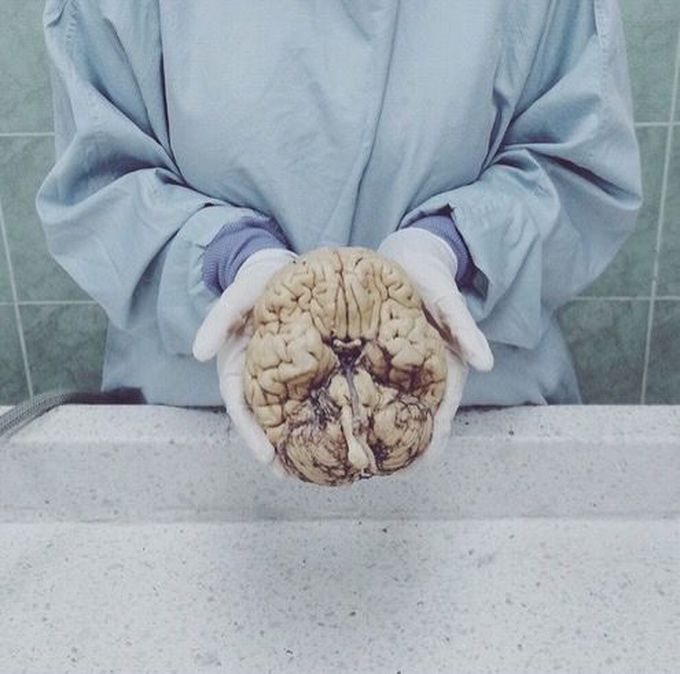 Human brain