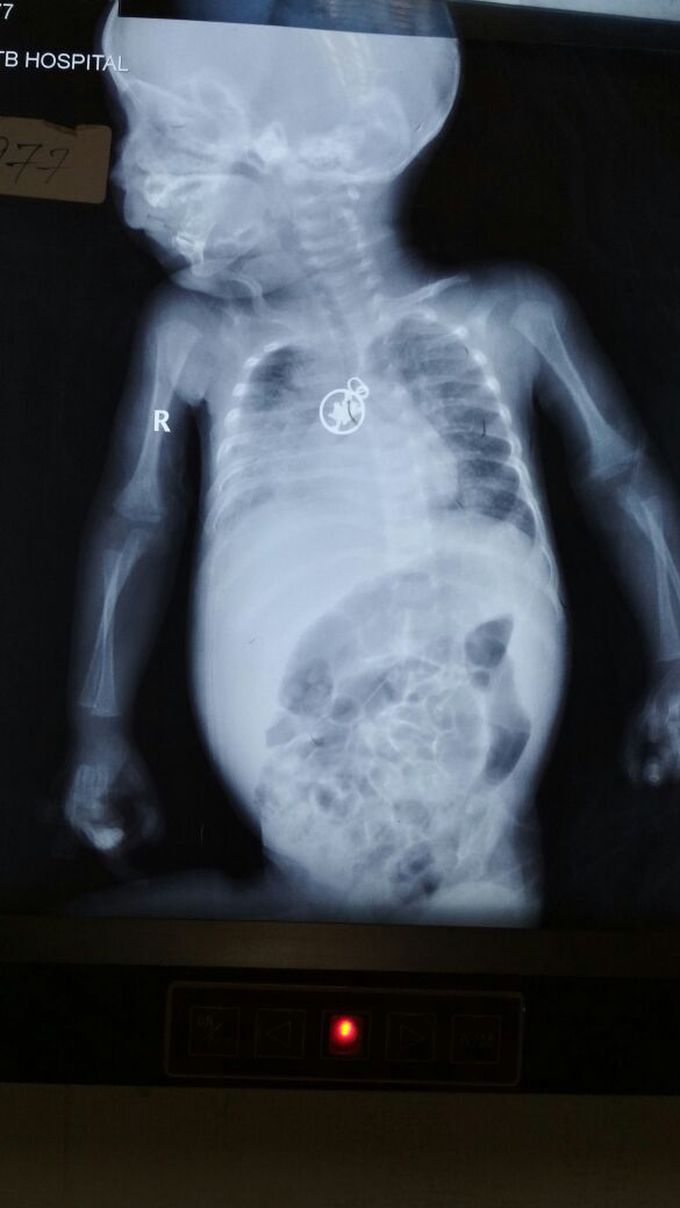 Diagnosis