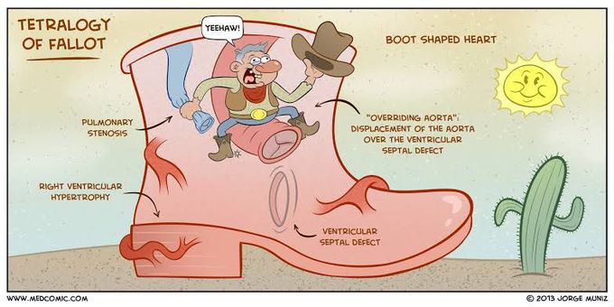 Tetralogy of Fallot Menomonic