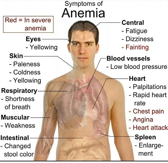 Symptoms of Anemia