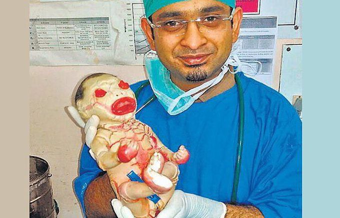 Ichthyosis