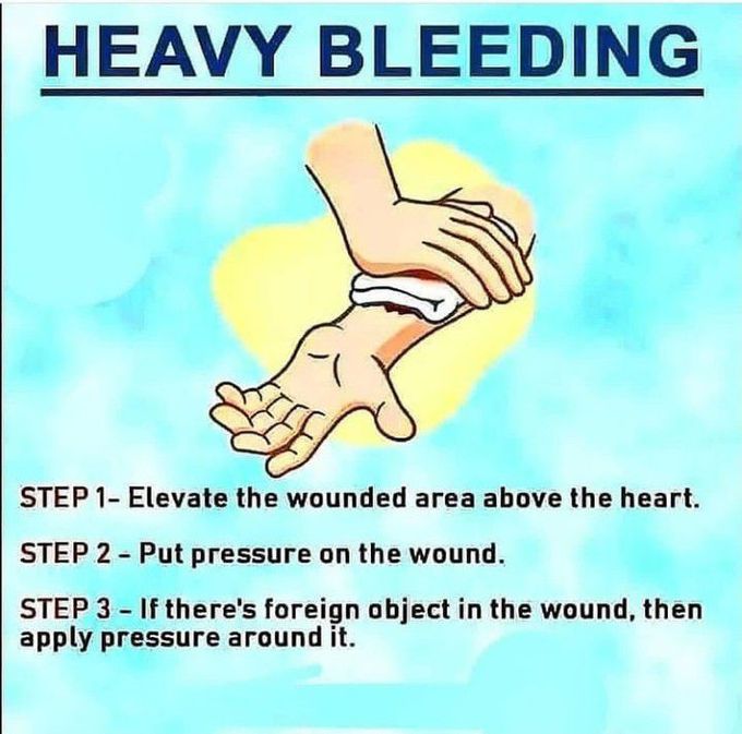 How to stop Heavy Bleeding?