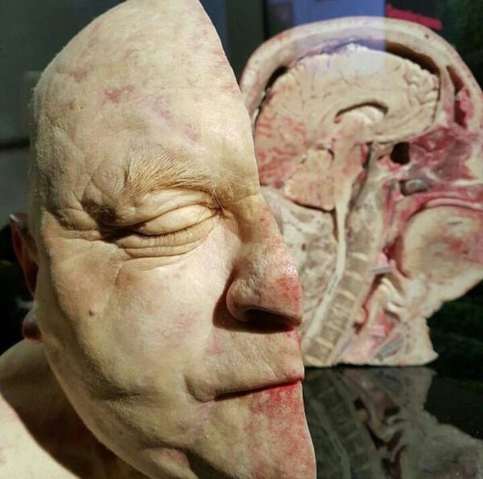Median sagittal cut of the head.