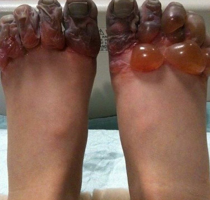 Diagnosis?