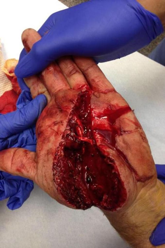 Hand vs. Skill Saw