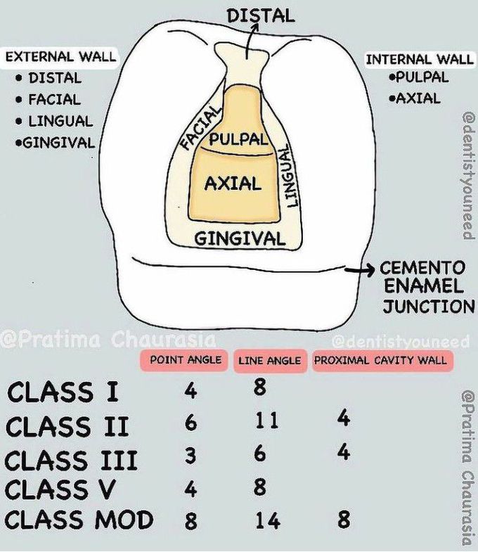 Basics in Cavity Preparation