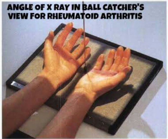 X-ray