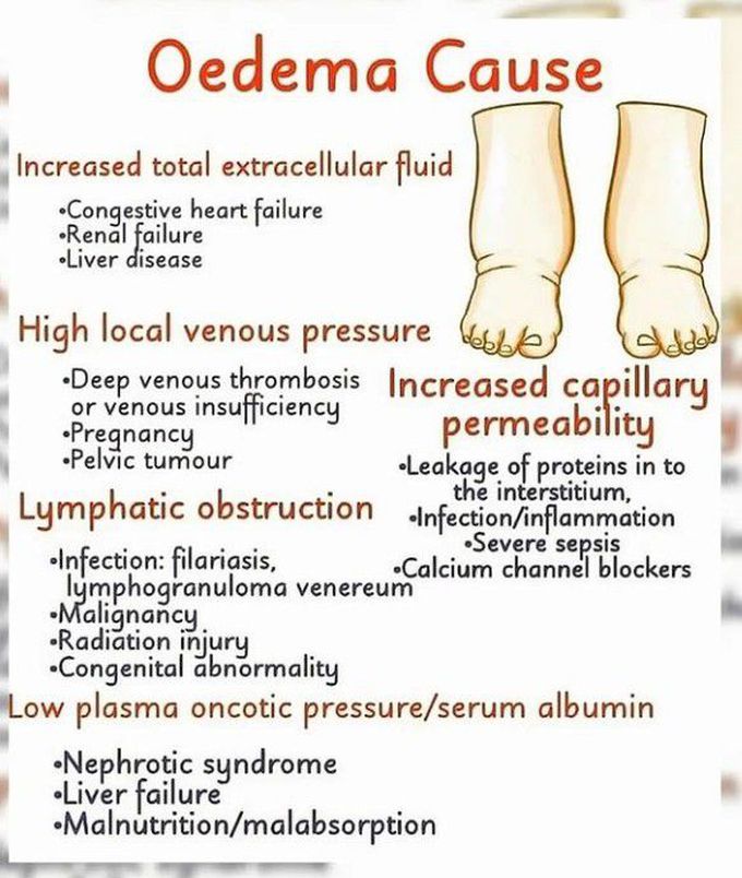 Causes of edema