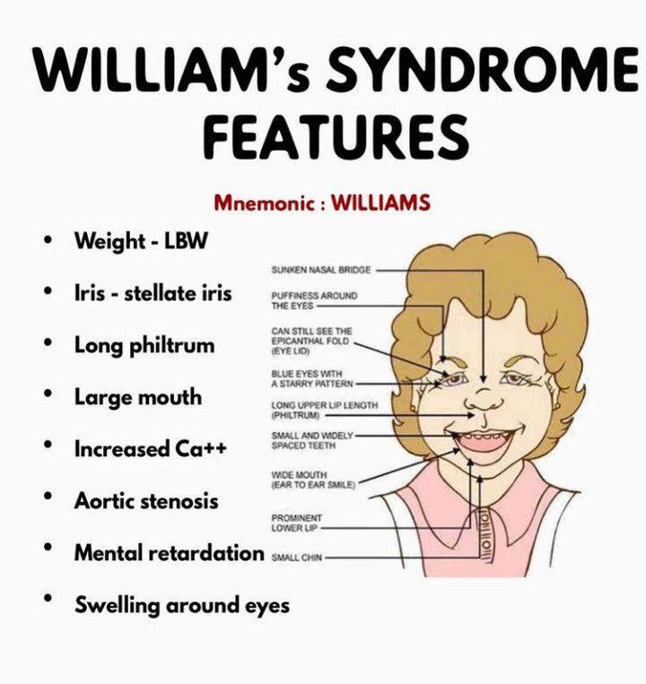 Williams syndrome-features - MEDizzy