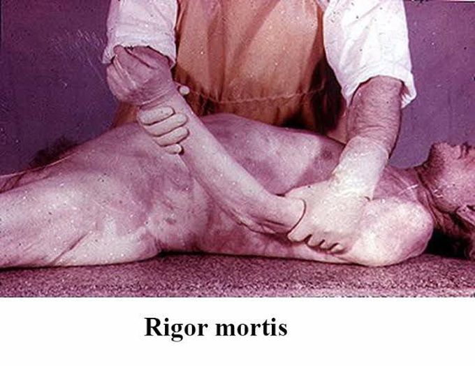 Rigor mortis