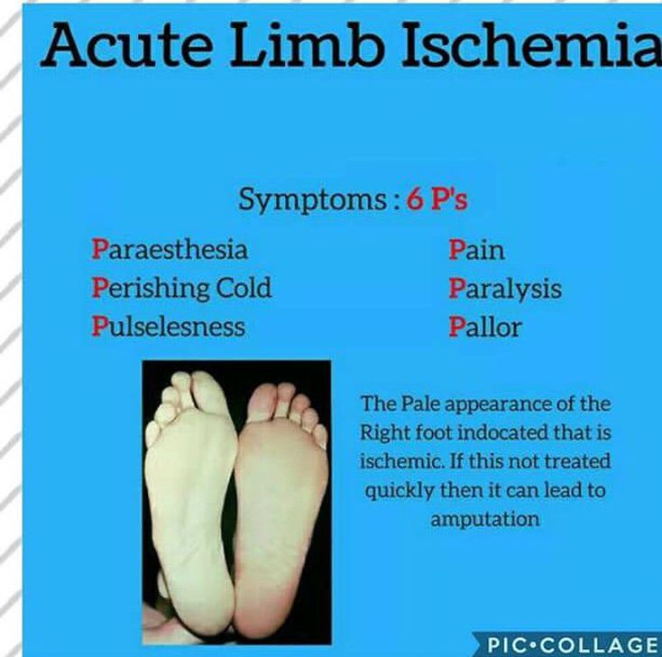 Ischemia Medizzy