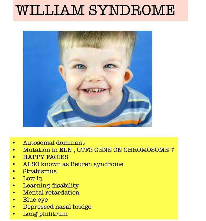 William Syndrome