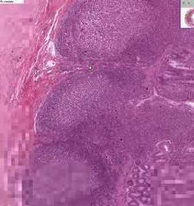 GIT- Identification of Ileum