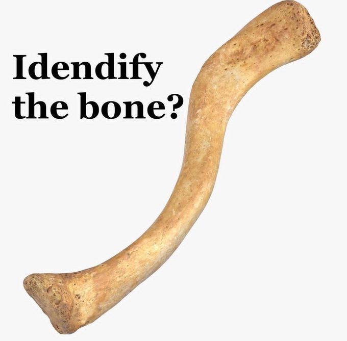 Identify the Bone