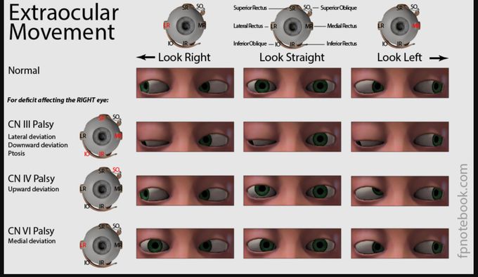 opthalmology (extra ocular movements)
