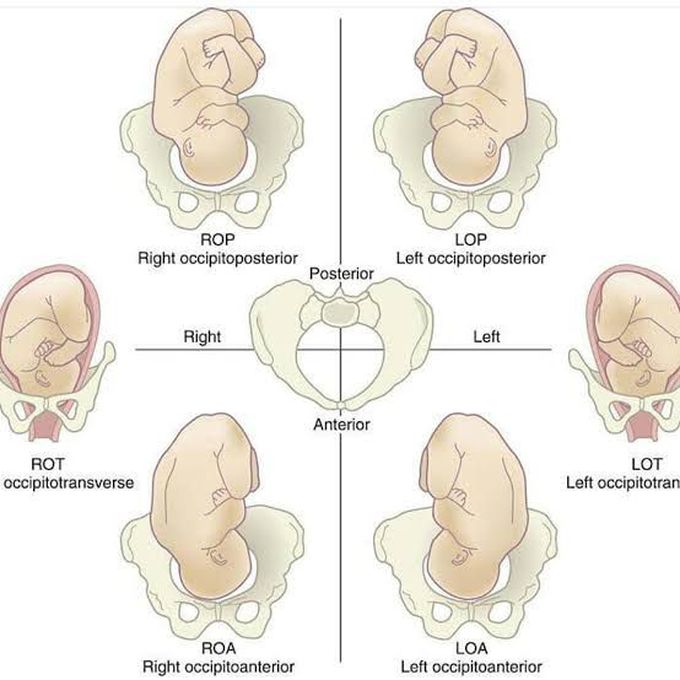 Position of Fetus
