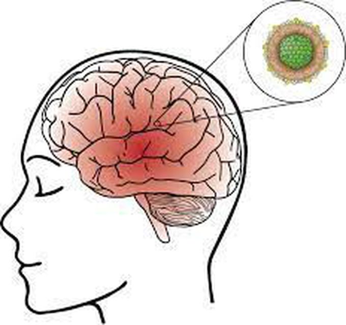 Treatment of encephalitis