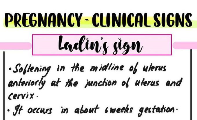 Ladin Sign