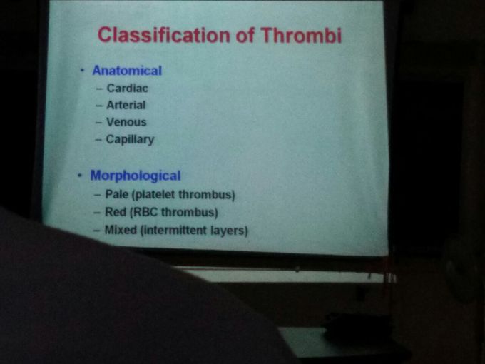 Thrombi