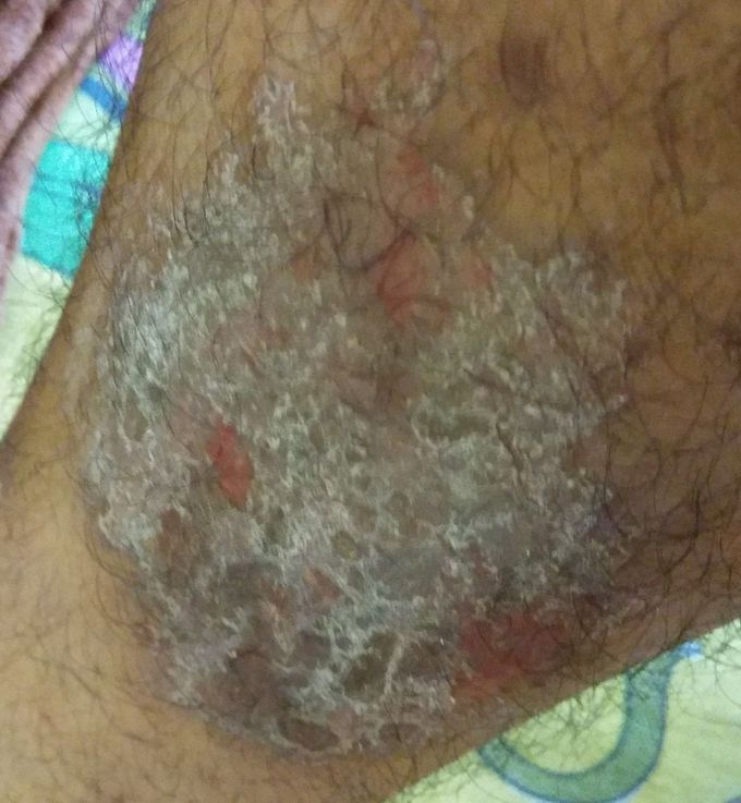 Diagnosis?and treatment