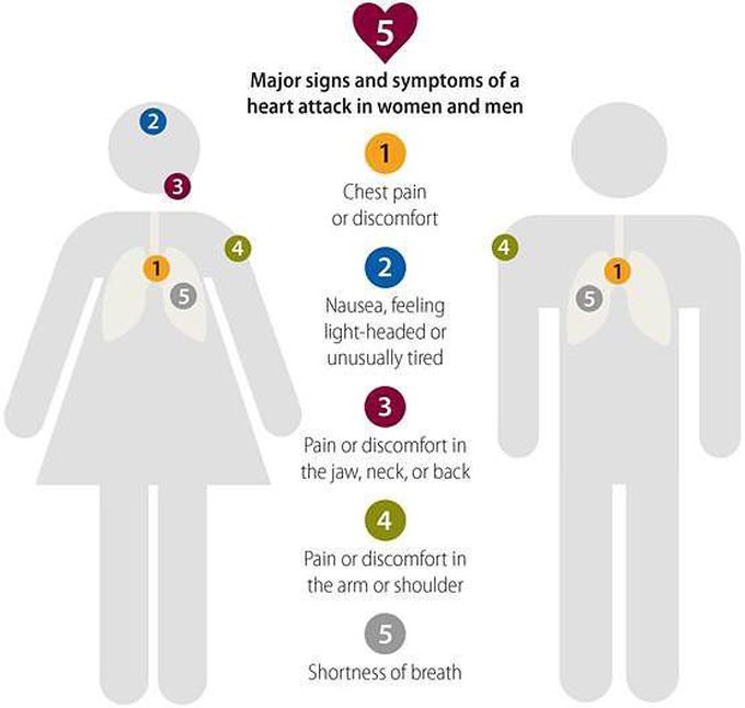 Heart attack symptoms in men and women