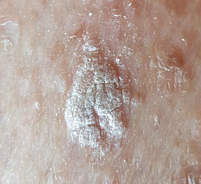 What is this?