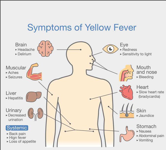 Yellow fever