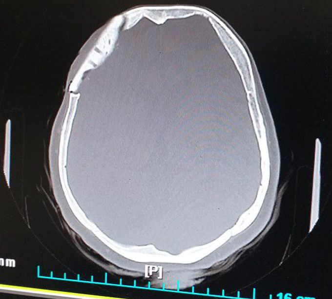 What is your diagnosis?