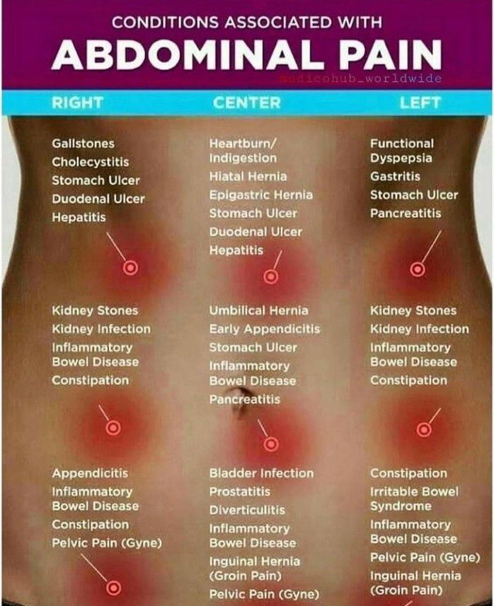Conditions associated with abdominal pain - MEDizzy
