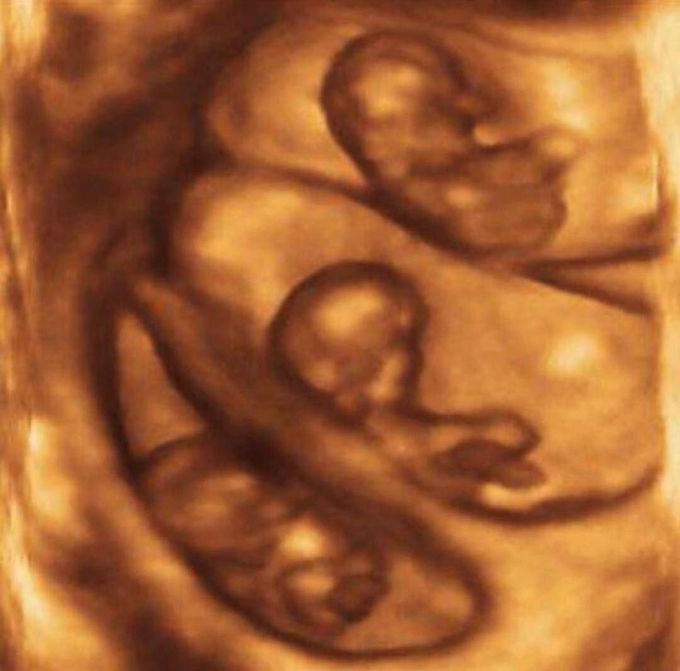 Why twins if you can have triplets right away. ❤️ 