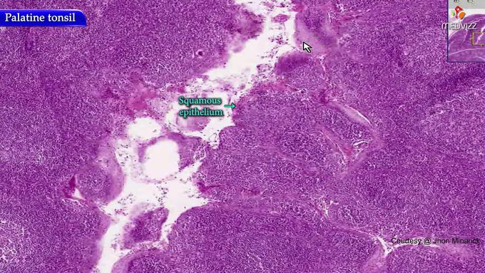 Histology of Palatine tonsils - Real time histology videos : High-yield USMLE Step 1