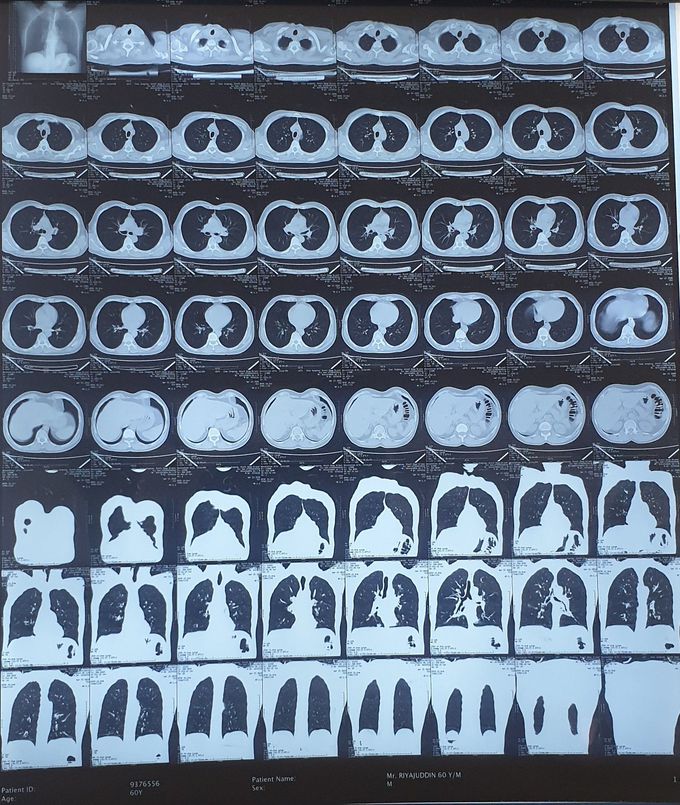 Diagnose??