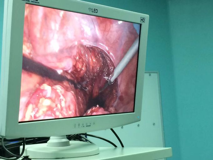 Gastrointestinal surgery