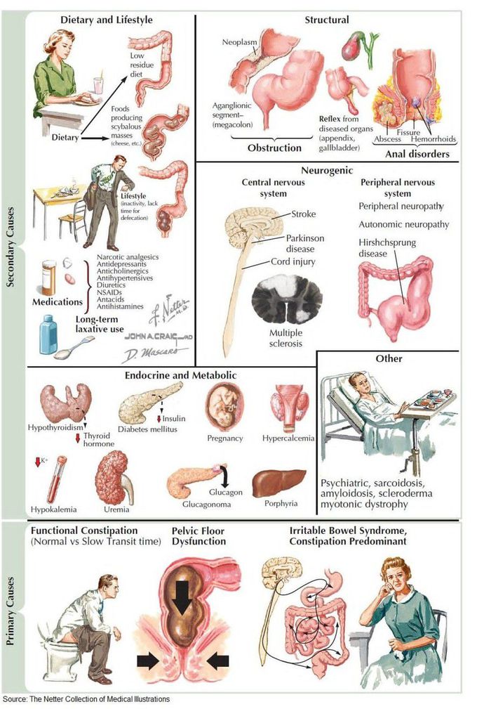 Signs of Constipation