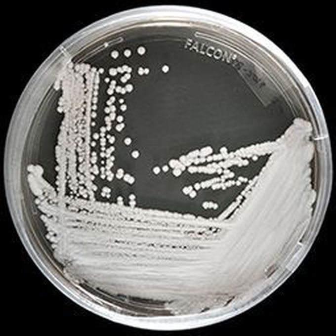 Candida auris outbreak: NJ, NYC area see over 400 cases of deadly fungus