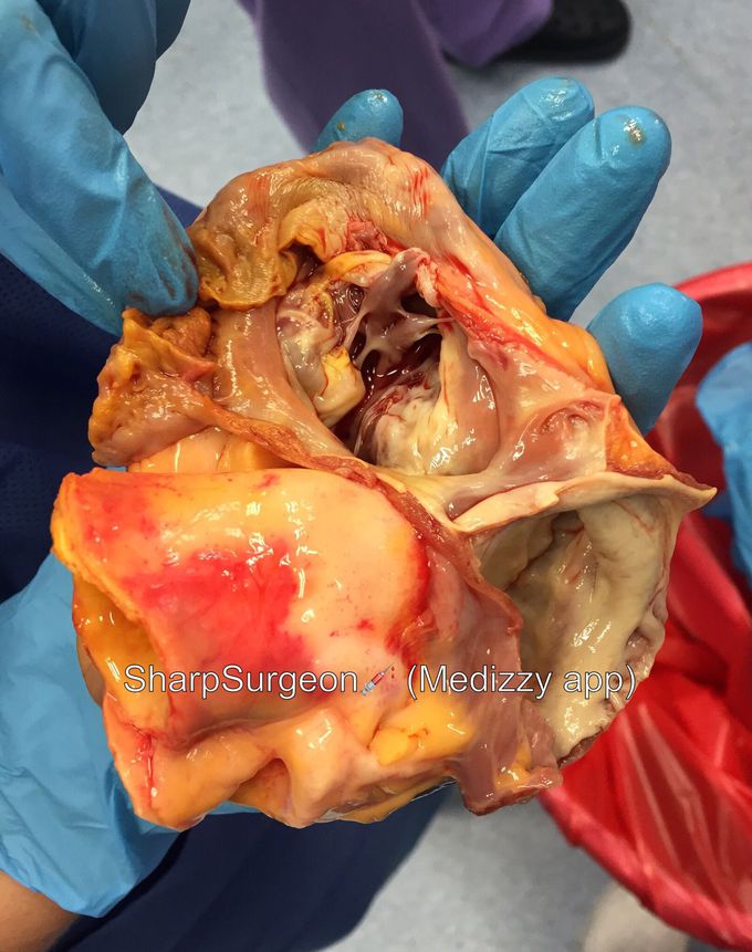 Human Heart ❤️