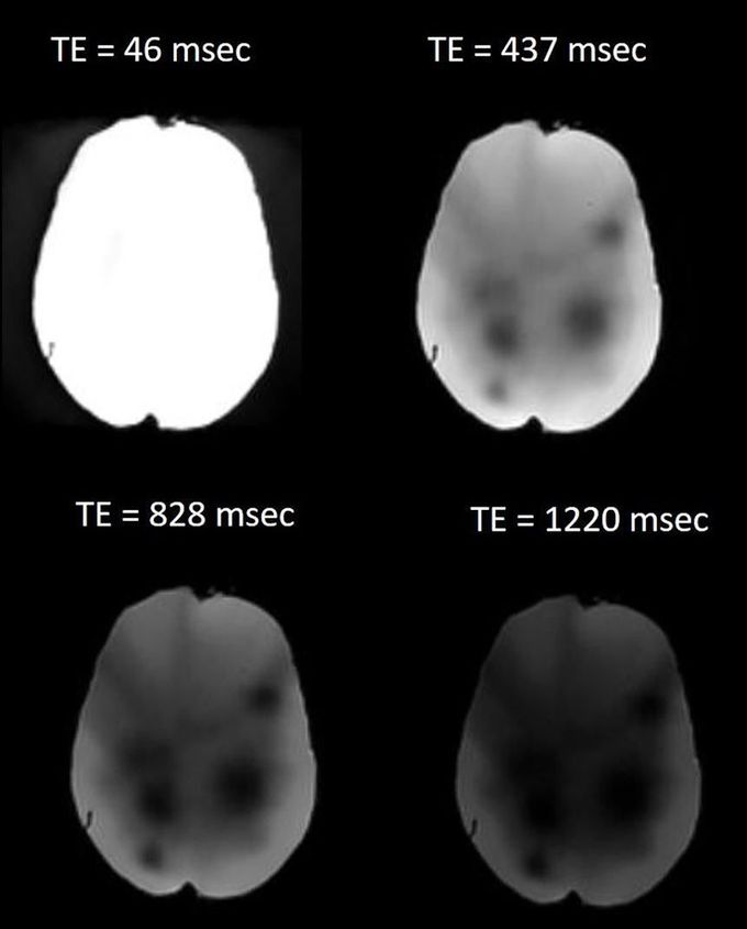 Figure illustrates the effect of different echo times (TE) on image signal-to-noise ratio (SNR)